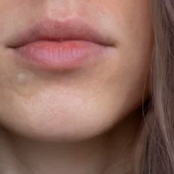 Australian Bodycare Pimple Patches (20 stk)