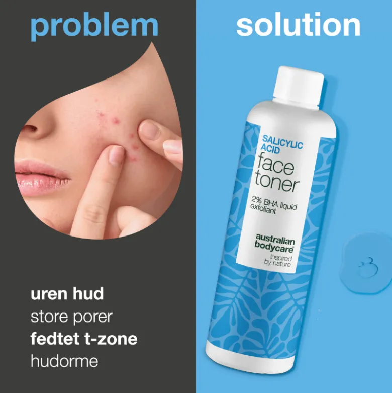 Australian Bodycare Salicylic Acid Face Toner 2% BHA Exfoliant (150 ml)