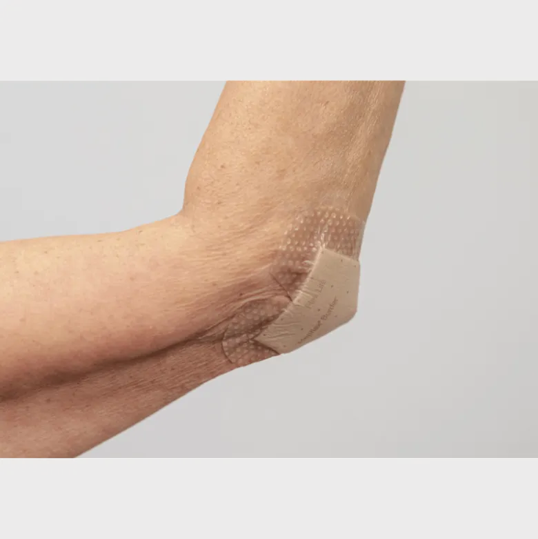 Mepilex Border Flex Lite Tynd Fleksibel Skum M. Silikoneklæb 4 x 5 cm (4 stk)