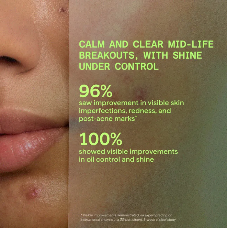 Murad Biome-Balancing Calm + Recover Cream (50 ml)
