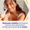 Nivea Luminous630 Anti Marks & Spots Body Cream (200 ml)