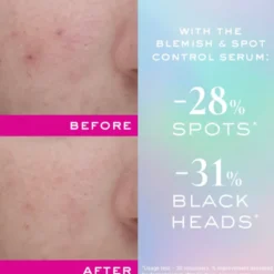 Nuxe Zinc Power Blemish & Spot Control Serum (30 ml)