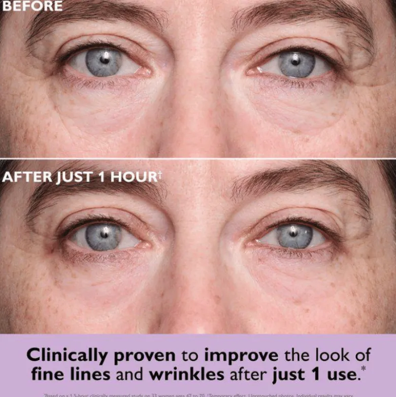 Peter Thomas Roth Instant FIRMx® Collagen Infusion Tightening Eye Patches (8 stk)