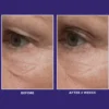 Peter Thomas Roth Ultimate Solution 5 Multitasking Eye Cream (15 ml)