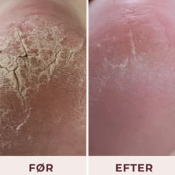 Pudderdåserne Alt I En Fodcreme (100 ml)