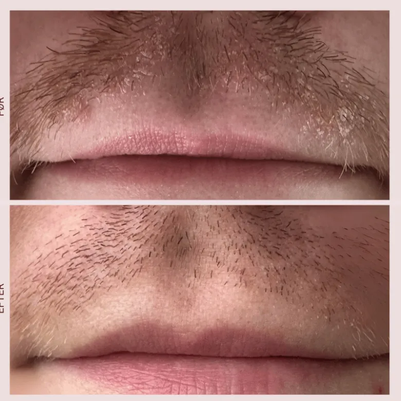 Pudderdåserne Skæl Serum (50 ml)