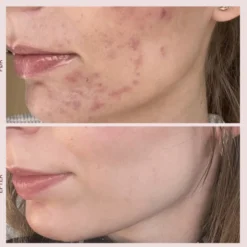 Pudderdåserne T-Zone Peeling (50 ml)
