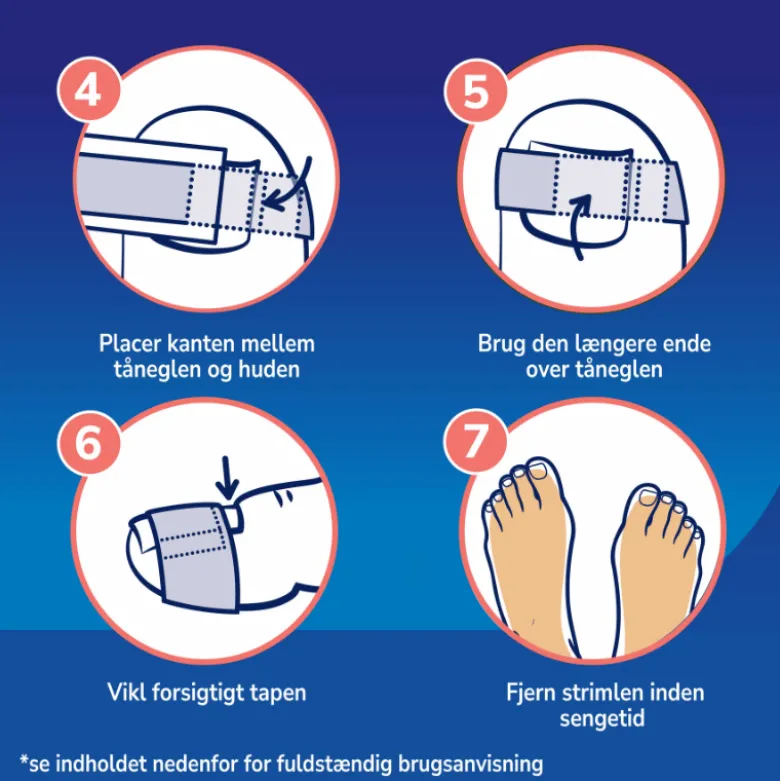 Scholl Ingrown Toenail Pain Relief Strips (10 stk)