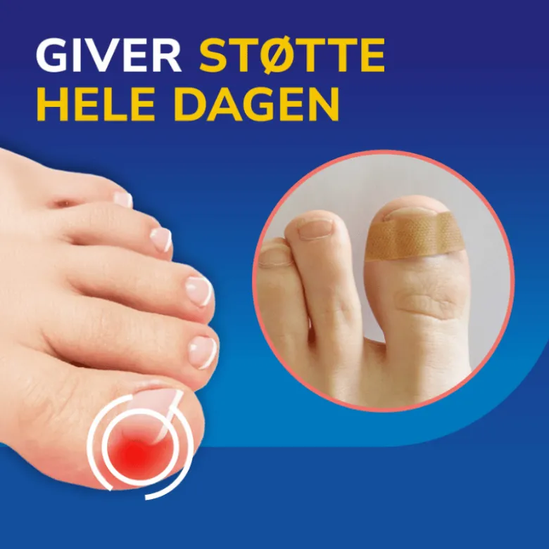 Scholl Ingrown Toenail Pain Relief Strips (10 stk)