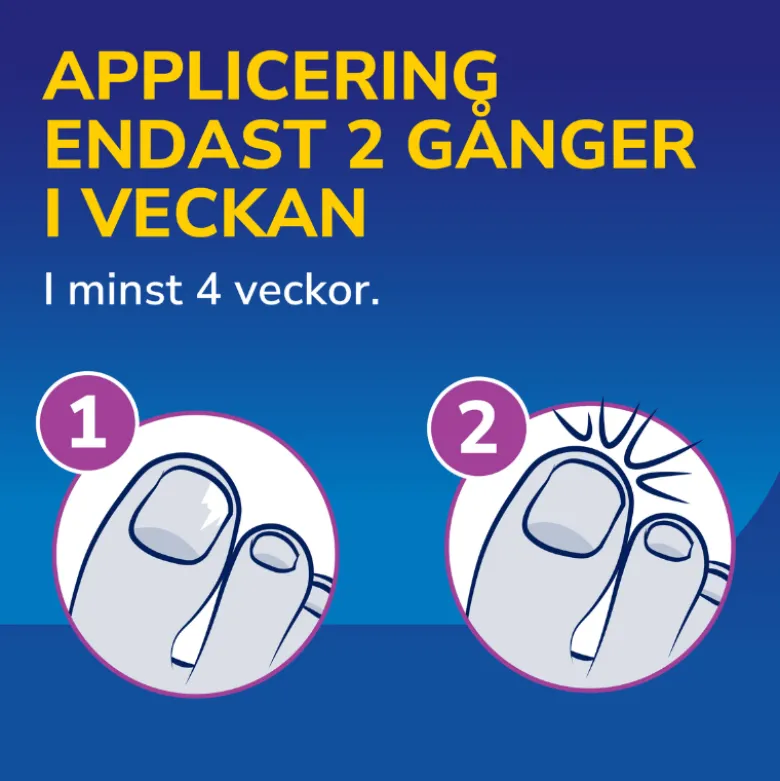 Scholl neglesvamp beh.(3,8 ml)