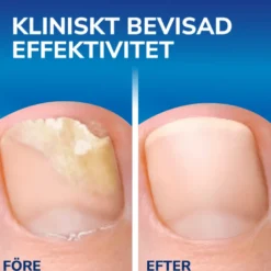 Scholl neglesvamp beh.(3,8 ml)